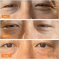 THE PHIX Caffeine Eye Cream 2oz — image 6