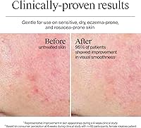 Neutrogena Hydro Boost Skincare Set, Fragrance Free Gel Cream & Cleanser, 1.7oz + 0.5oz — image 11