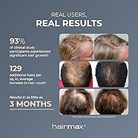 Hairmax LaserBand 82 — image 13