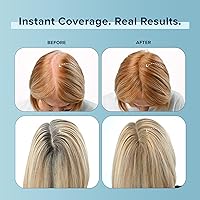 TRUHAIR Color Fibers Root Coverage Medium Brown — image 9