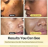 Gleamin Superactive Vitamin C Serum 15% with Niacinamide, Bakuchiol & Hyaluronic Acid 1oz — image 2