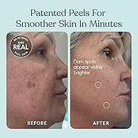 Beautiste 30 Day Miracle AHA 30% + BHA 2% Peeling Solution — image 6