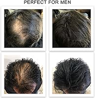 FEBRON Hair Fibers Dark Brown 30g — image 7