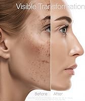 Airoks A+B Exfoliating & Repair Face Pads 30 Count — image 8