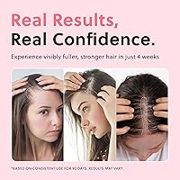 Forchics Revolutionary Hair Regrowth Serum 50ml — image 3