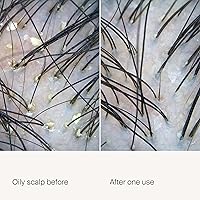 Living Proof Scalp Care Exfoliator 3.53oz — image 2