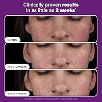 Paula’s Choice Pro Retinaldehyde Dual-Retinoid Advanced Treatment Serum 3.53oz — image 4