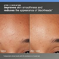 Dermalogica Discover Healthy Skin Kit — image 5