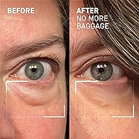 Dr. Brandt Needles No More No More Baggage Eye De-Puffing Gel, 0.23oz — image 10