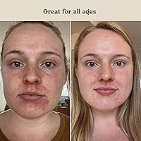 Roe Wellness Baby Serum Hydrating Skincare 6.84oz — image 7