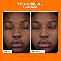 Paula's Choice 25% Vitamin C Serum, 1oz — image 5