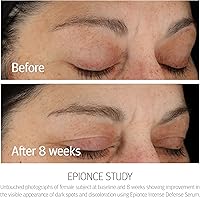 Epionce Intense Defense Serum 1.6oz — image 3