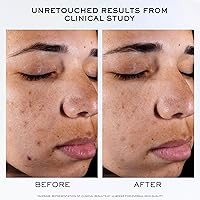 Lancôme Clarifique Pro-Solution Face Serum 1.0oz — image 4