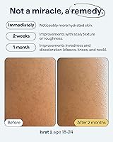 Remedy Science KP Body Treatment Lotion – 5.5oz — image 5