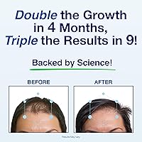 Phyllotex Hair Growth Vitamins for Women & Men, 1 Month Supply — image 4