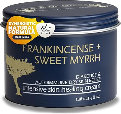 Balm of Gilead Foot Healing Cream – Frankincense & Sweet Myrrh 4oz