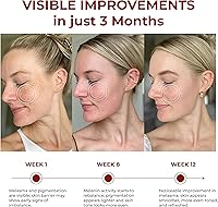 ABERA Saffron Serum for Melasma Treatment, 1.01 Fl Oz — image 5