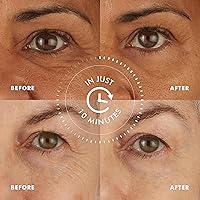 skyn ICELAND Hydro Cool Firming Eye Gels, 8 Pairs — image 3