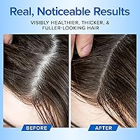 DermaChange Natural Hair Growth Shampoo and Conditioner Set - 16oz — image 5