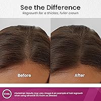 C'rcle Minoxidil for Women 5% Foam 4-Month Supply — image 3