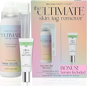 Skin Clinic Ultimate Skin Tag Removal Kit Review
