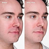 Clinique Acne Solutions Clinical Clearing Gel 1.13oz — image 3