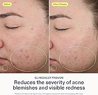 Skinfix 2% BHA Spot Treatment 0.5oz — image 4