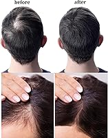 Infinix Black Rice Oil with Tea Tree – 2-Bottle Combo (2 oz Each) — image 8