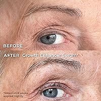 Wunderbrow Growth Enhancer Brow & Lash Serum — image 2