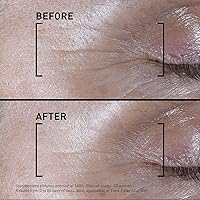 Filorga Time-Filler Shot Serum 0.5 fl. Oz. — image 4