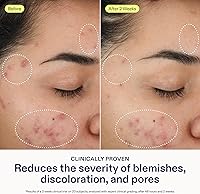 Skinfix 2% BHA Cleanser 5oz — image 4