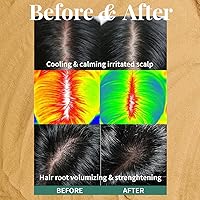 PLU Korean Therapy Scalp Scaling Scrub with Silicone Scalp Massager Brush — image 4