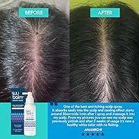 Suu Balm Dry Scalp Treatment Spray 1.35oz — image 6