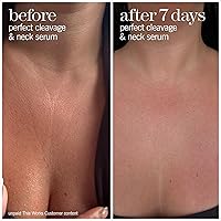 THISWORKS Perfect Cleavage & Neck Serum 5 fl oz — image 3