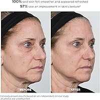 M-61 PowerGlow Peel Extra Strength 20% Glycolic Acid Facial Peel — image 7