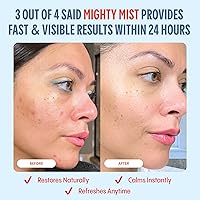 Mighty Mist Premium Hypochlorous Acid Spray for Acne & Eczema, 4oz — image 5