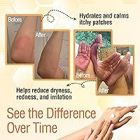 Wild Naturals Manuka Honey Moisturizer 4oz — image 3