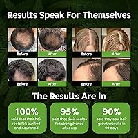 Kovilea Rosemary & Biotin Hair Growth Shampoo 10.1oz — image 2