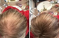 Caboki Hair Loss Concealer Light Brown 30G — image 3