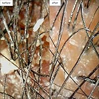 Briogeo Scalp Revival Soothe + Detoxify Minis Kit — image 2