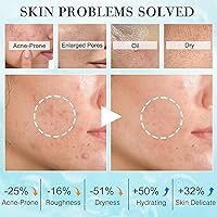 FITOEG Teen Women Skincare Routine Kit — image 5