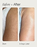 Topicals Slather Exfoliating Body Serum 5 Fl Oz — image 4