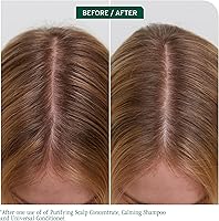 Biolage Scalp Sync Universal Conditioner 33.8oz — image 3