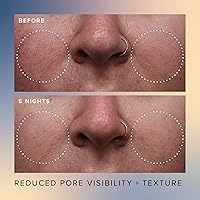 Farmacy Honey Glow Serum 17% AHA + BHA Exfoliant (30mL) — image 4