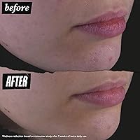 Kiehl's Calendula Herbal Extract Alcohol-Free Toner 4.2oz — image 6