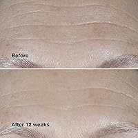 Clinique Smart Clinical Repair Wrinkle Correcting Cream SPF 30, 50mL — image 4