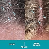 DS Labs Dandrene Dandruff Shampoo 205mL — image 4