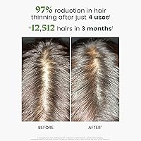 Rene Furterer Triphasic Reactional Concentrated Serum - 12 ct. — image 3