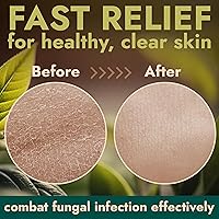 Terramed Antifungal Body Wash with Tea Tree Oil 16.9 oz — image 4