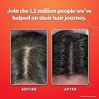 HAIRtamin Scalp Serum — image 4